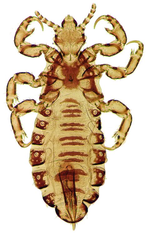 Head lice .